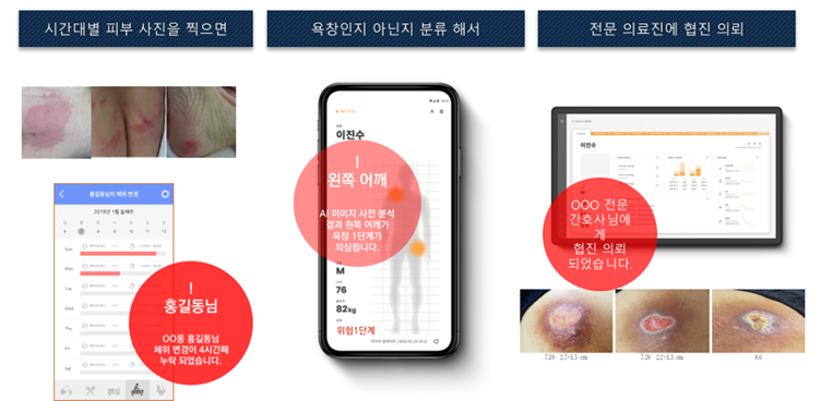 욕창_치료 프로토콜